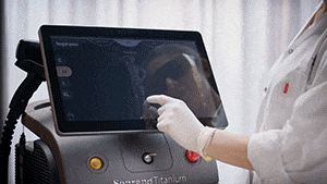 Haarentfernung mit Alma Soprano