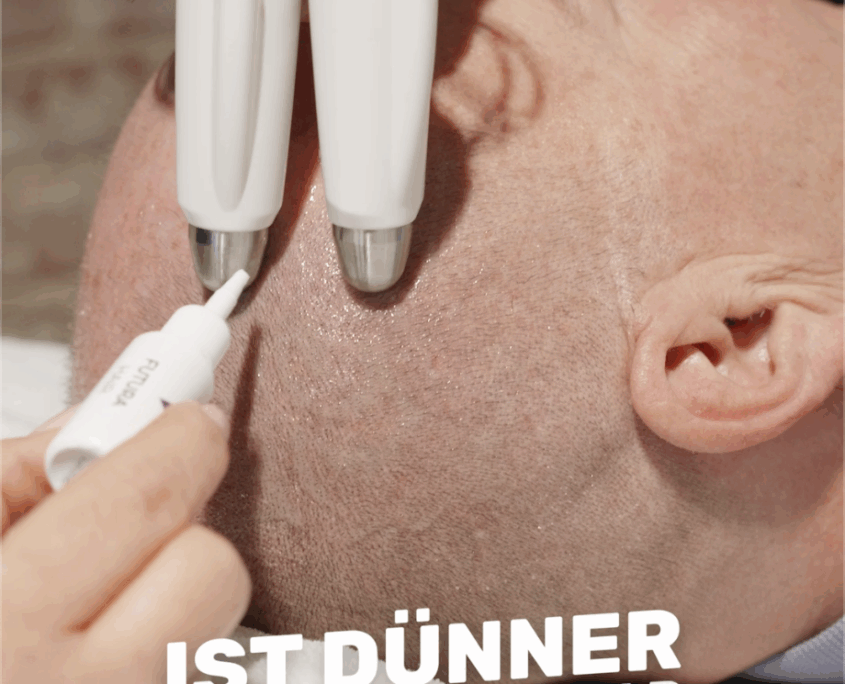 FUTURACONTOUR Kopfbehandlung Haarausfall Behandlung