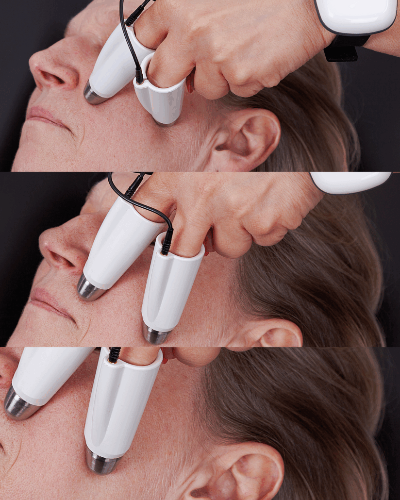 Behandlung im Gesicht Futuracontour Behandlung im Gesicht